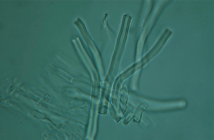 Ritrovamento n 5 del 26-11-2011 (Irpex lacteus)